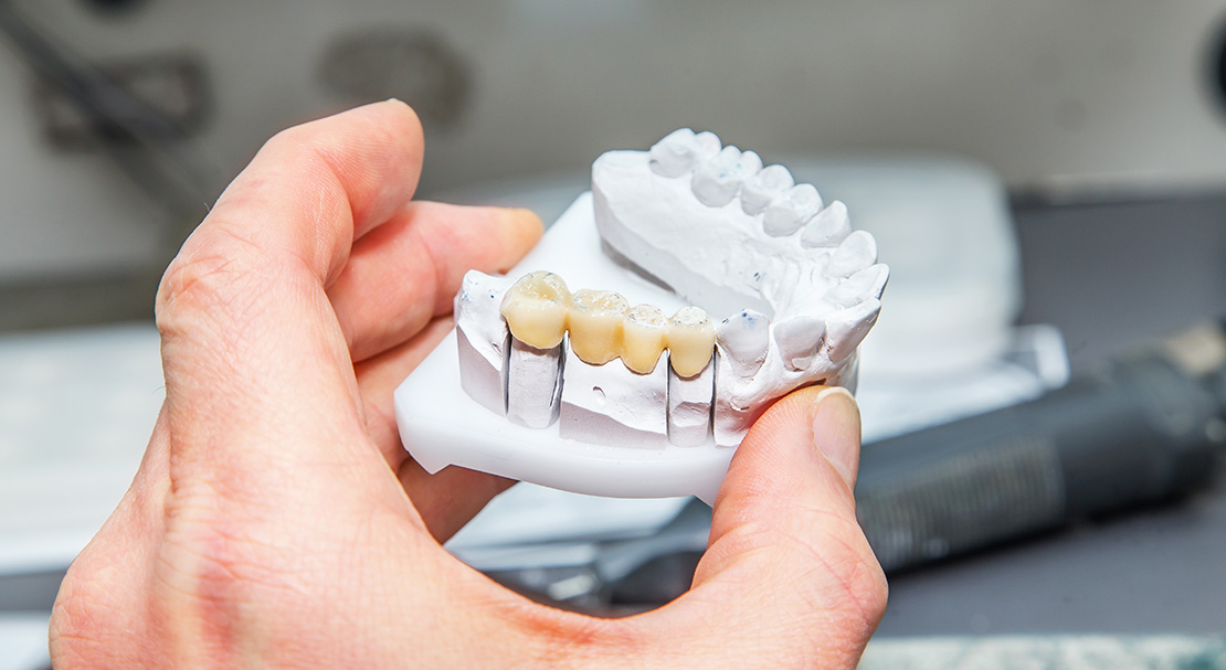 Clarksburg Dental Center | Same Day Crowns, Restorative Dentistry and Implant Dentistry