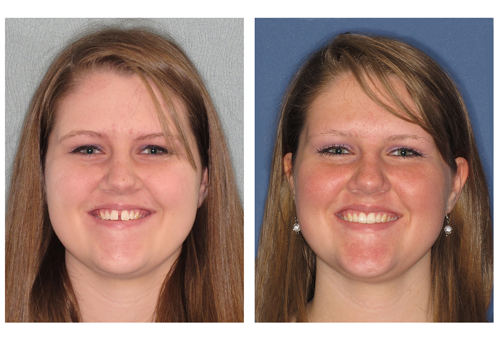 Clarksburg Dental Center