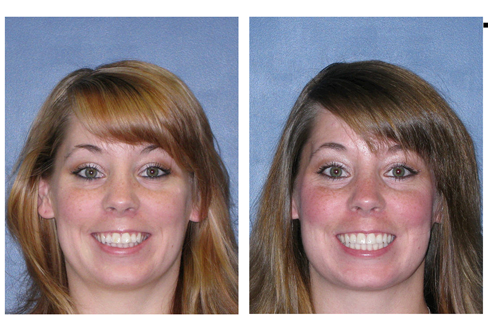 Clarksburg Dental Center