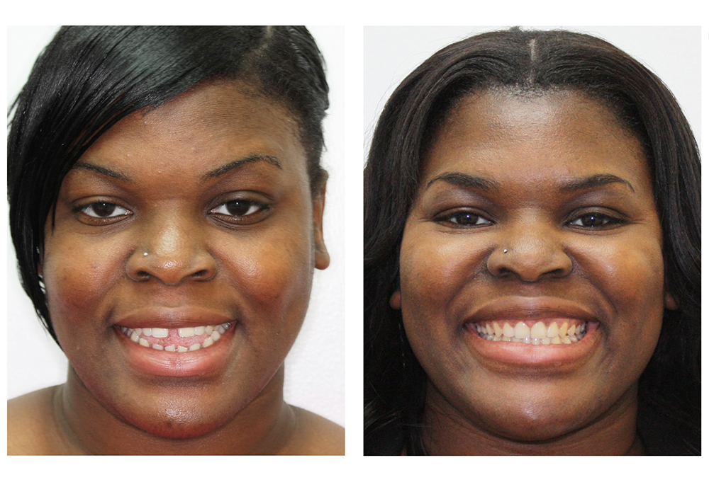 Clarksburg Dental Center