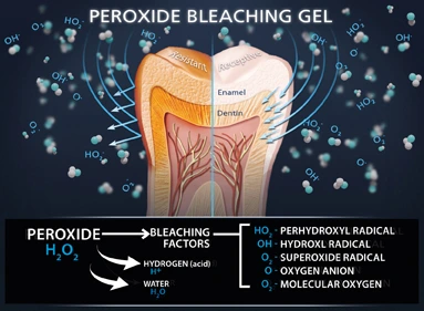 peroxide bleaching gel