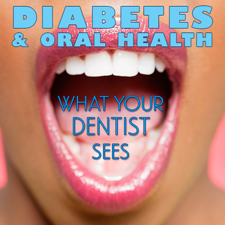 Germantown dentist, Dr. Liu & Dr. Lin of Clarksburg Dental Center, discusses the side effects of diabetes and how it affects your oral health.