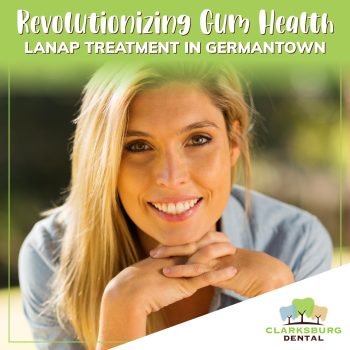 Discover LANAP laser gum treatment at Clarksburg Dental Center in Germantown, MD. Minimally invasive, effective solution for gum disease. Schedule your consultation today!