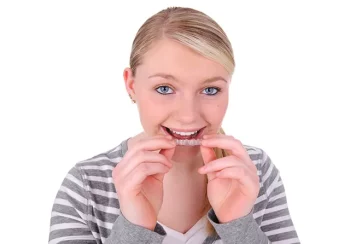 Invisalign for Teens