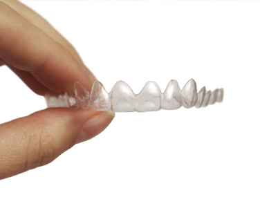 Invisalign clear aligners